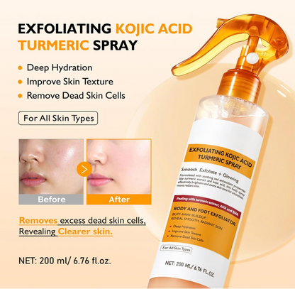 200Ml KOEC Kojic Acid Turmeric Exfoliating EvenTone Lab Dark Spot Fade Spray – Exfoliating Body Mist for Smooth, Even-Toned Skin (200ml)