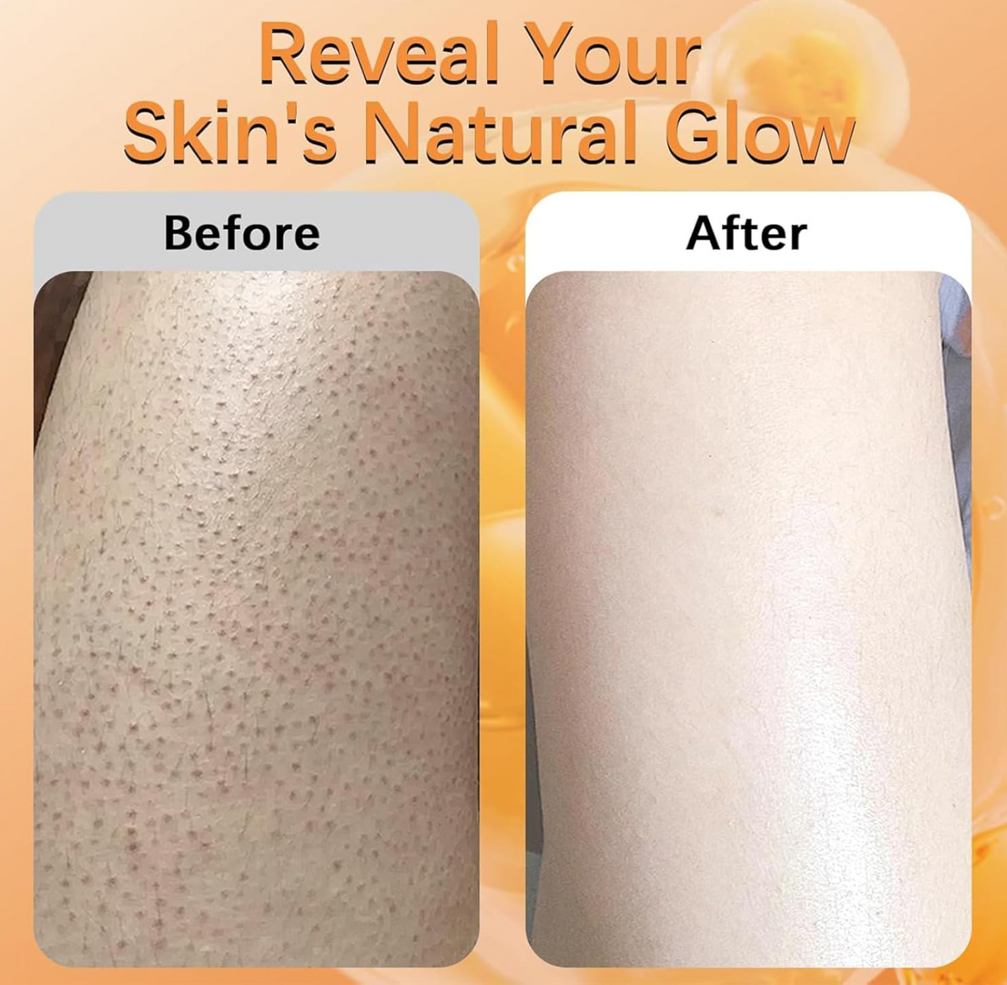 200Ml KOEC Kojic Acid Turmeric Exfoliating EvenTone Lab Dark Spot Fade Spray – Exfoliating Body Mist for Smooth, Even-Toned Skin (200ml)