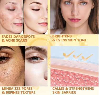 200Ml KOEC Kojic Acid Turmeric Exfoliating EvenTone Lab Dark Spot Fade Spray – Exfoliating Body Mist for Smooth, Even-Toned Skin (200ml)